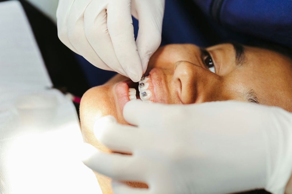 Child receiving braces adjustment by Dr. Boris at Evanston, ensuring proper orthodontic care.