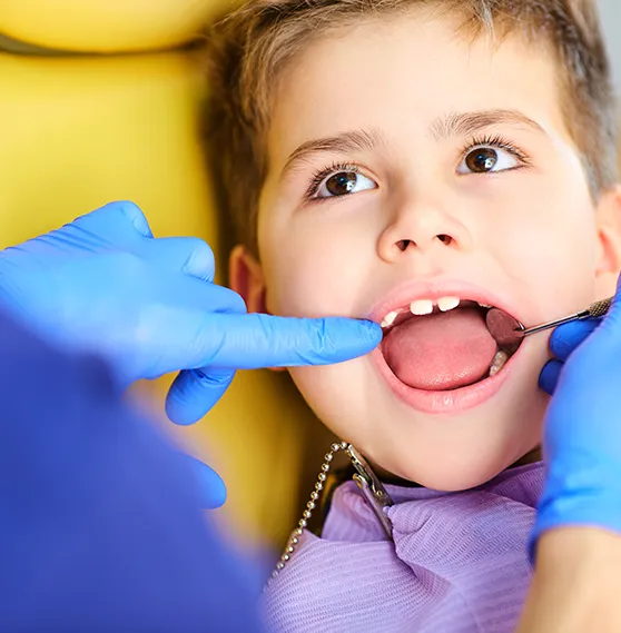 Child receiving a dental check-up with a dentist examining teeth using a dental mirror.