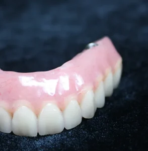 Flexible partial denture crafted by Dr. Boris Kaltchev for comfortable dental solutions.