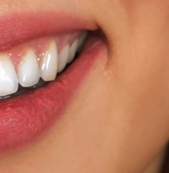Close-up of a bright, white smile with healthy teeth and pink lips.